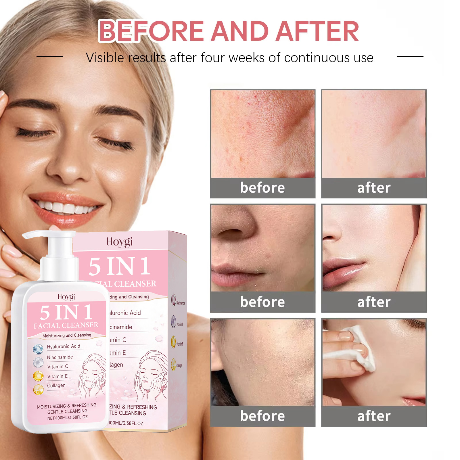 5-in-1 Hydraterende Gezichtsre - Kiss Beauty Makeup Remover recensie en prijs